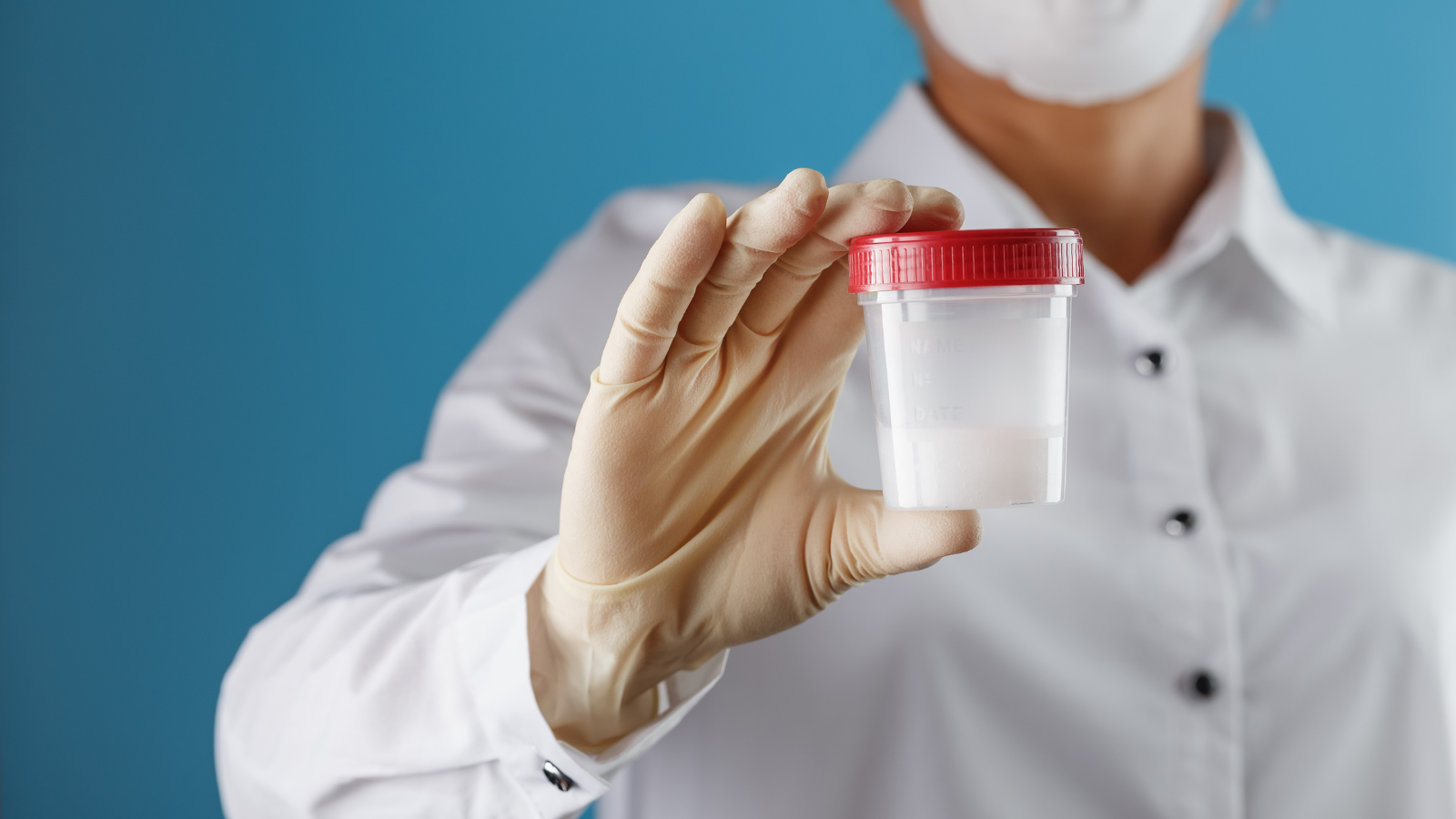 El donante entregó muestras durante años sin detectar su mutación. Sus espermas llegaron a muchos países y ya nacieron casi 200 niños; 23 heredaron la mutación y 10 ya tienen cáncer.